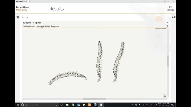 Программа аппарата  Spinal Mouse. Диагностика позвоночника.