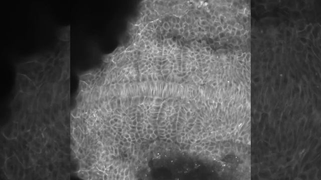 Somitogenesis in zebrafish смотреть онлайн