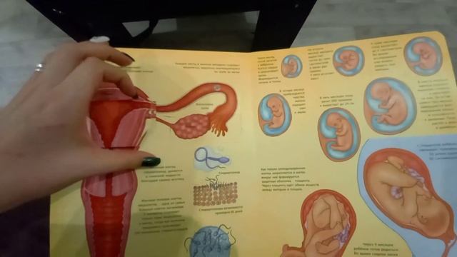 🤰Некоторые причины бесплодия. Муж заболел перед новым годом. 💊 смотреть онлайн