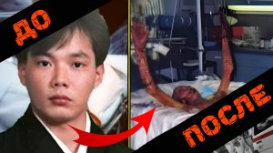 «Кожа вместе с мясом отваливалась от тела..» Самый страшный несчастный случай в истории..