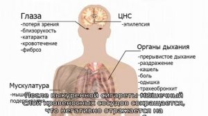 Гипоксия у новорожденных