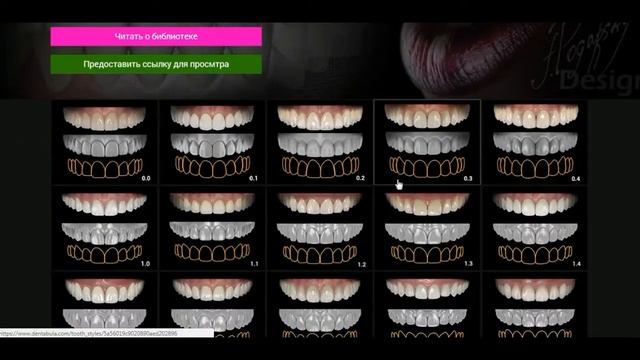 Promo Dentabula смотреть онлайн