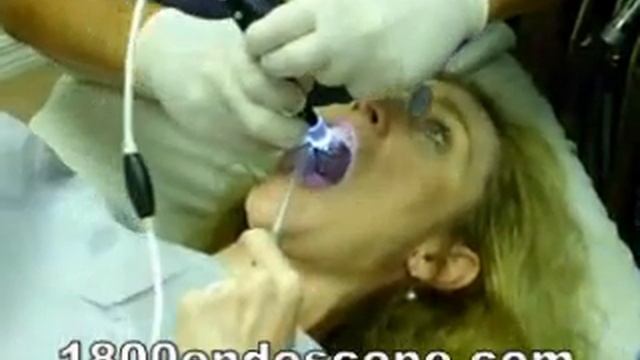 etime dental ehe dental cam pencam penscope procedure смотреть онлайн