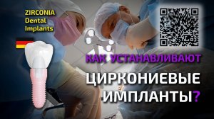 Циркониевые импланты как устанавливают?  ZIRCONIA DENTAL IMPLANTS #циркониевыеимпланты