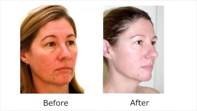 DMK A Lift смотреть онлайн