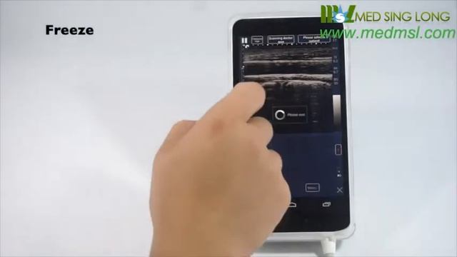 Medsinglong Mini pocket-sized usg color ultrasound scan machine смотреть онлайн