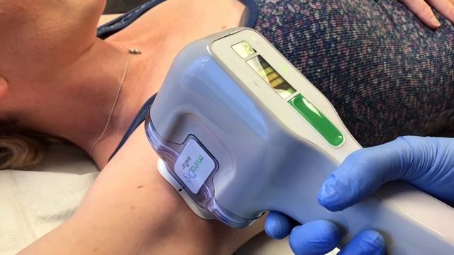 MiraDry - Permanent Reduction of Excess Sweating and Odor - Dr. Anthony Youn смотреть онлайн