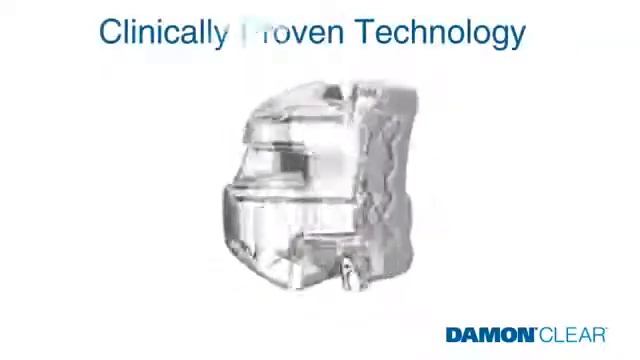 Damon Clear Invisible Braces 360p смотреть онлайн