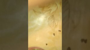 Супер чистотел. Удаление бородавки. Первый этап