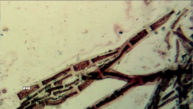 Ficología comparada: Algas verdes (Chlorophyta) смотреть онлайн