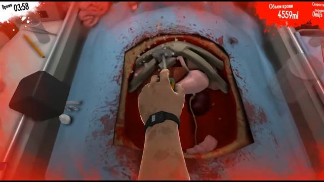 Surgeon Simulator: пересаживаем почки