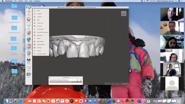 Tarea No. 5 con meshmixer encerado digital puente de 6 unidades, Dr. Rafael Domínguez смотреть онлайн