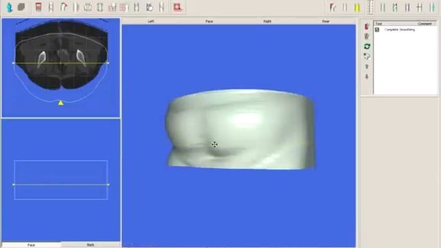 Dicom File Rodin4D смотреть онлайн