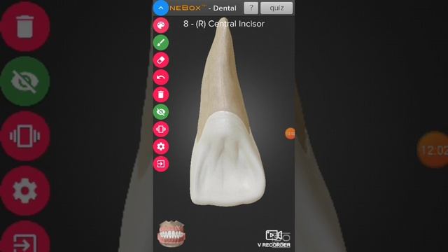 Maxillary central incisor description 3D смотреть онлайн