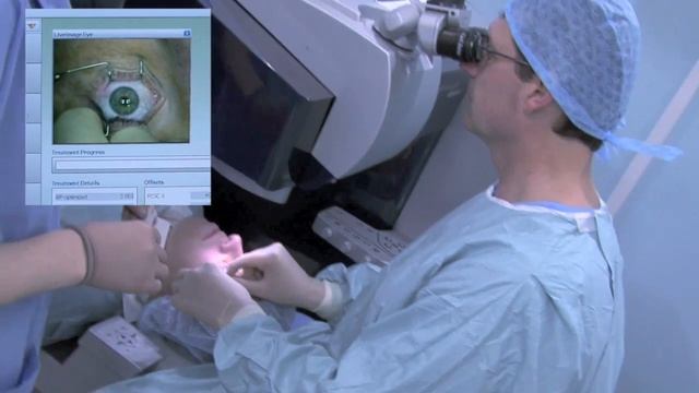 Real Time Bilateral LASIK Surgery with the Refractive Suite from Alcon WaveLight смотреть онлайн
