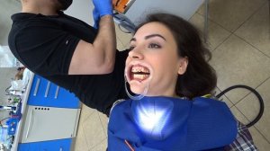 УСТАНОВКА БРЕКЕТОВ