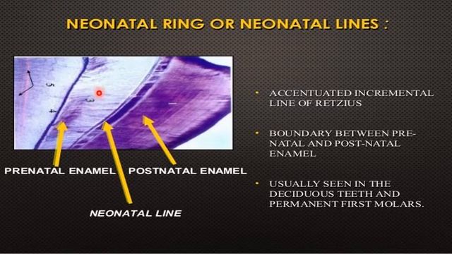 Enamel structures: Prof.Dr. Nada AL-Ghaban, College of Dentistry/ Baghdad University смотреть онлайн