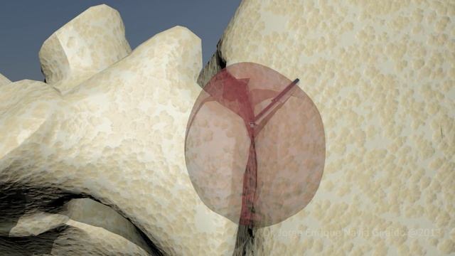 Dr. Navia - Animación Médica 3D смотреть онлайн