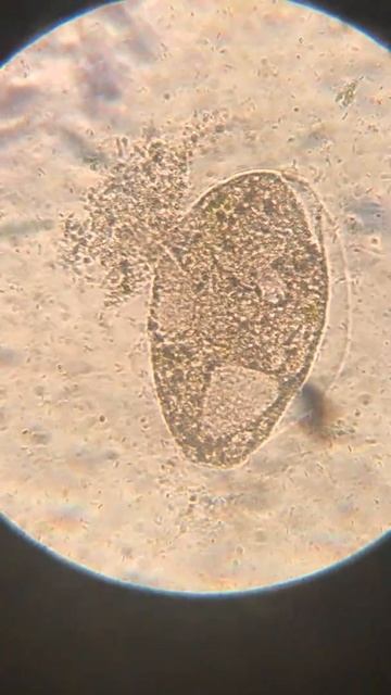 Paramecio expulsando desechos (Biología IB) смотреть онлайн