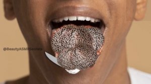 ASMR Remove Maggots From Infected Hand | ASMR 2D Animation Treatment | Severely Injured Animation