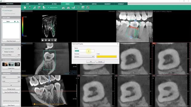 Ez3D-i Endo смотреть онлайн