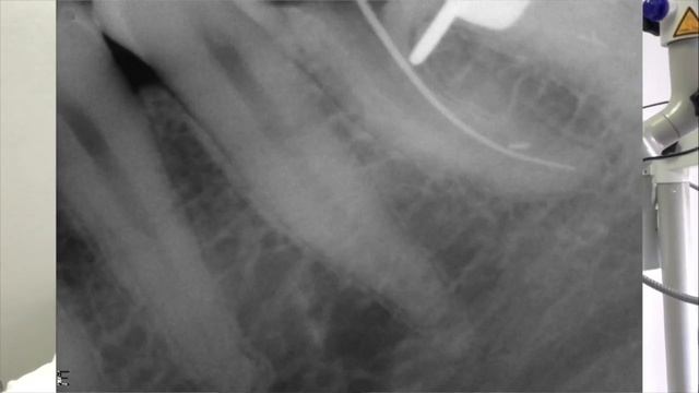 DentalПлюшки 35 - файлы SOCO SC Pro смотреть онлайн