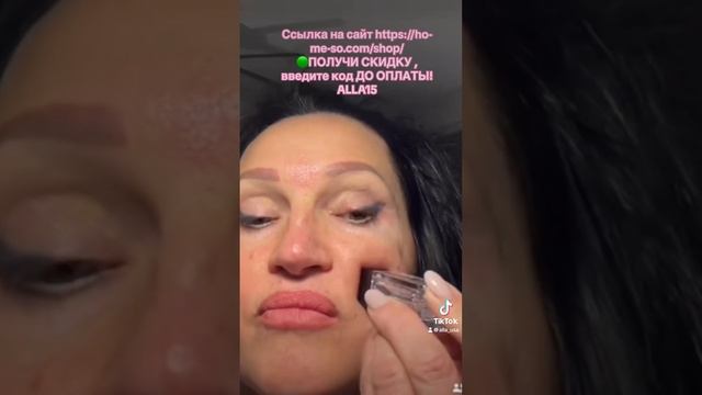 #764. Пошаговая инструкция,использую домашнюю мезотерапию. 🟢HO•ME•SO 🟢 Делюсь результатами!