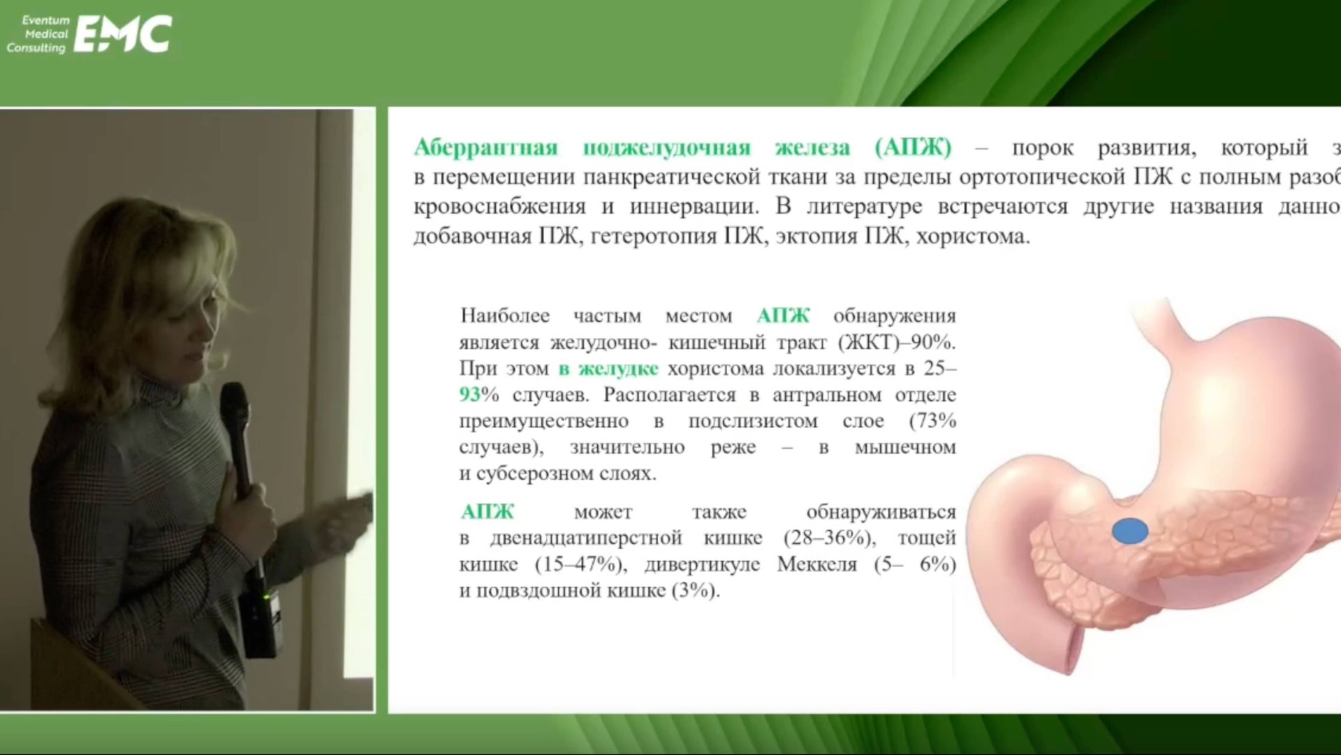 4. Кошурникова А.С., Кузьмин А.С. ЭУС диагностика аберрантной ПЖ у детей, оперировать или нет?