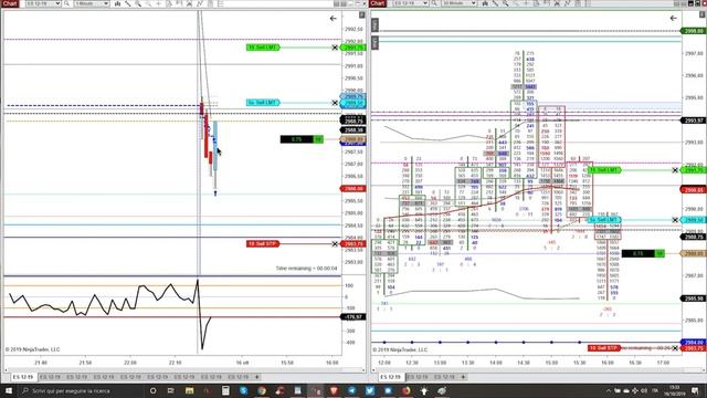 16 October 2019 - Long After Big Smart Buyers Have Been Entered Into The Market - Market Profile смотреть онлайн