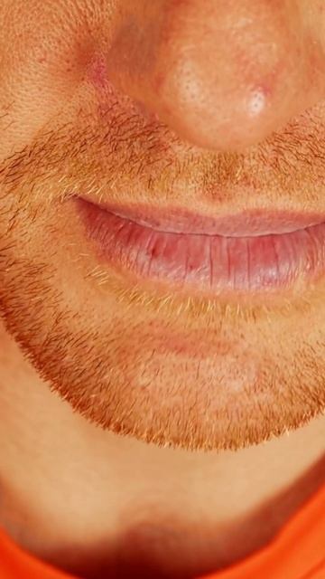 Space Between The Teeth (Diastema) - Causes, Treatment, And Considerations