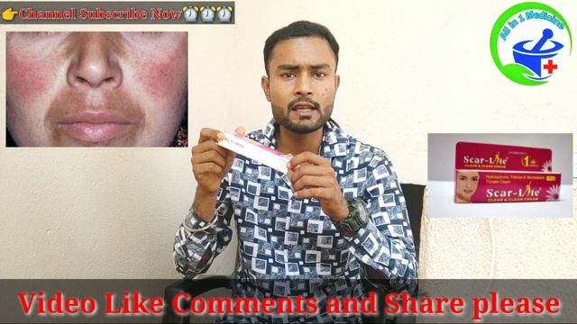 Scar Lite Skin Cream Kaise Use Kare  | Scar Lite Skin Cream | Scar Lite Cream Review | Scar Lite