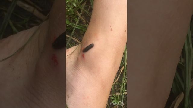 Нападение пиявок#пиявка#пиявки#обитатели водоема#nature#речные пиявки