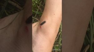 Нападение пиявок#пиявка#пиявки#обитатели водоема#nature#речные пиявки