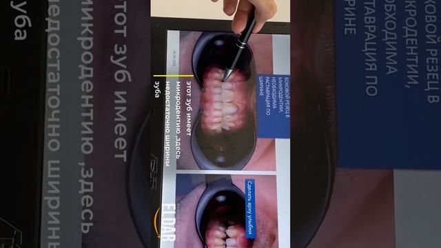 ОРТОДОНТИЧЕСКИЙ ПЛАН ЛЕЧЕНИЯ (РАЗБОР) смотреть онлайн