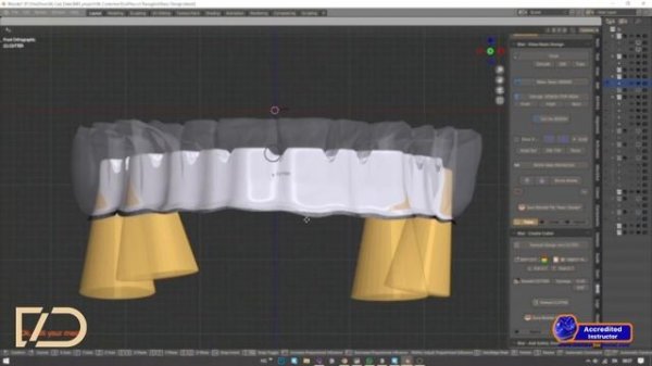 iBAR B4D: Use Creativity in Dental Design