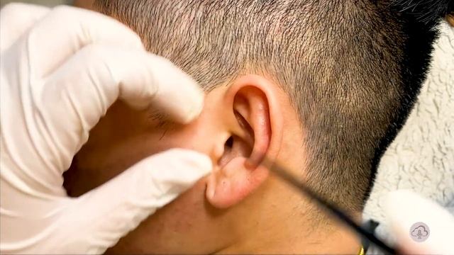 ASMR| Worlds’s Greatest Ear Cleaning/Ear Wax/Professional Massage W/Mika (Right Ear)
