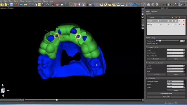 Sequential Guides for Implant placement смотреть онлайн