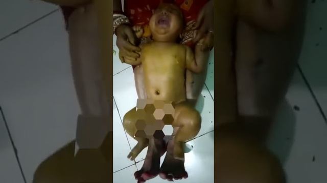 kn pain sai kanduchhi video dekhile jani paribe😱 смотреть онлайн