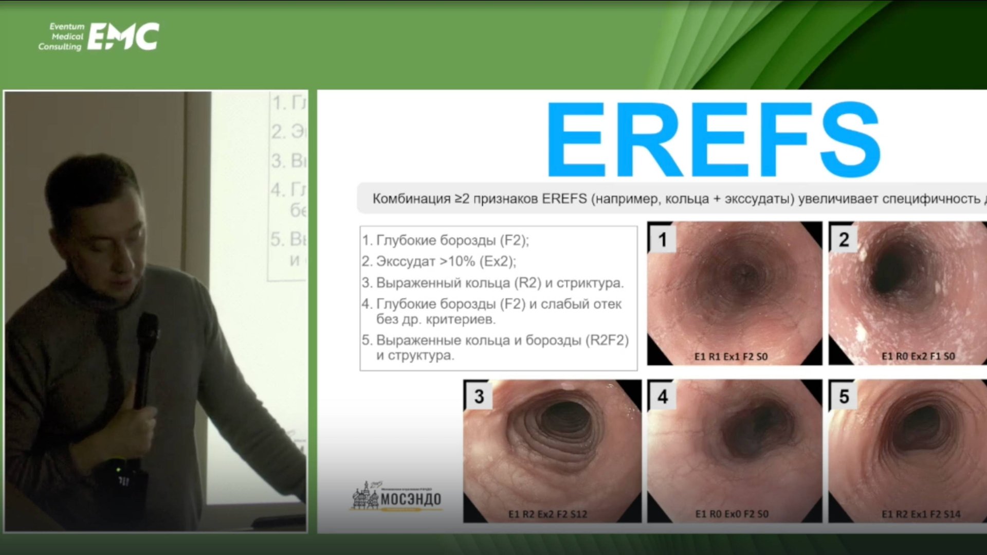 5. Валиулин И.Р., Агейкина Н.В. Эозинофильный эзофагит: вспоминаем изученное и изучаем новое.