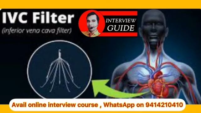 IVC Filter | Inferior vana cava filter | Army Doctor questions | Ssc afmc | Interview Guide смотреть онлайн