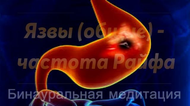 Язвы (общие) - частота Райфа смотреть онлайн