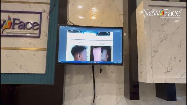 Planning For Jaw Surgery? Free Online Consultation - 8330077198 | Dr Mathew PC смотреть онлайн