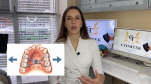 Пластинки для выравнивания зубов у детей: за и против. Мнение врача-ортодонта