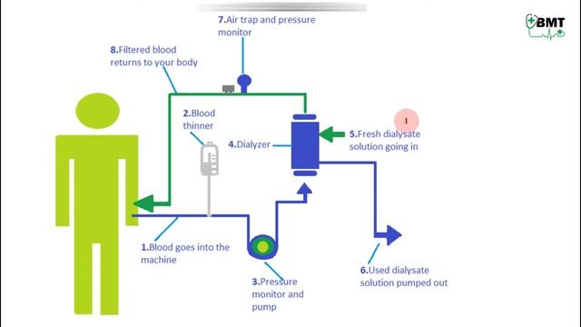 Basic concept of Dialysis Machine | Fresenius 4008S | Dialyzer & Dialysate Function смотреть онлайн