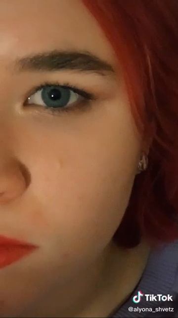 Алёна Швец и её глаз🗿