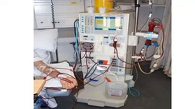 Hemodialysis Basics and Arterio-Venous Fistula Examination, Ahmed El Saeed, MD смотреть онлайн