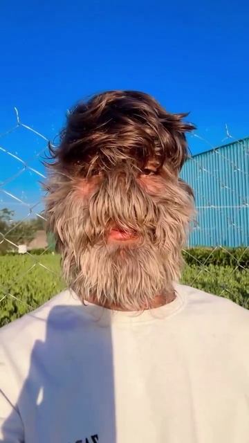 18-летний индус стал самым волосатым мужиком в мире. Лалит Патидар попал в Книгу рекордов Гиннесса смотреть онлайн