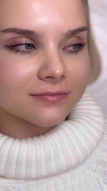 Какие эмоции вызывает у вас пациентка? 😍 Сделали губы более объемными и чувственными💓