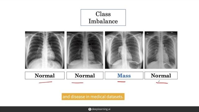 Practical Challenges Training with Medical Data (AI For Medicine) смотреть онлайн