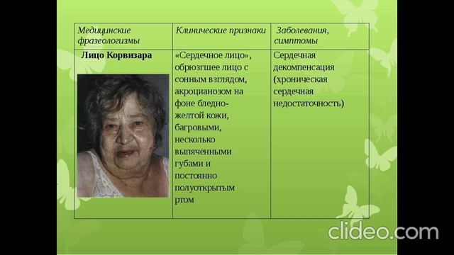 Лицо Корвизара смотреть онлайн